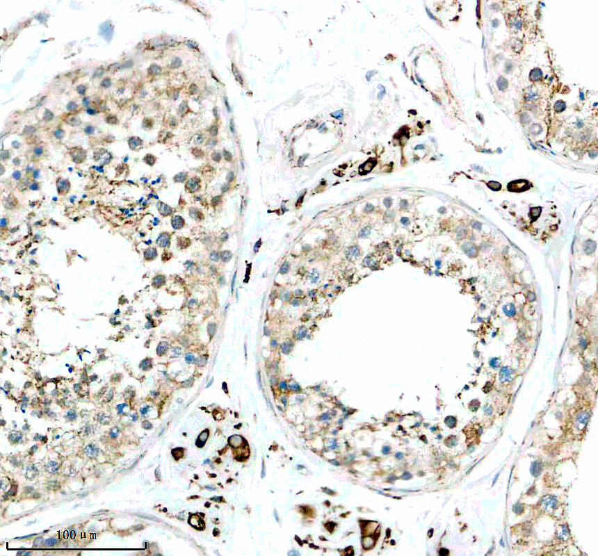 IHC analysis of CYP17A1 using anti-CYP17A1 antibody (M00615-1)