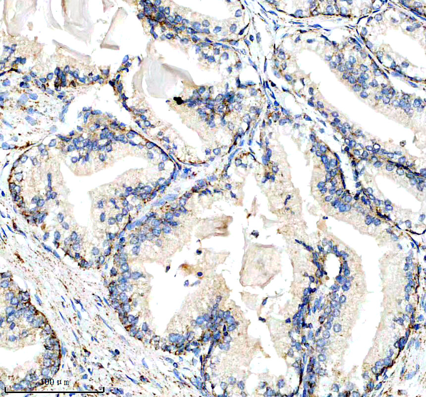 IHC analysis of CYP17A1 using anti-CYP17A1 antibody (M00615-1)
