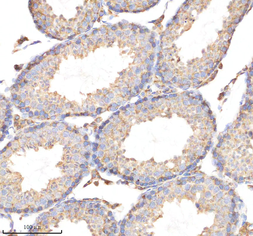 m00615 1 cyp17a1 primary antibodies ihc testing 3
