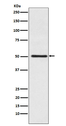 Western blot analysis of Cytochrome P450 17A1 expression in Jurkat cell lysate