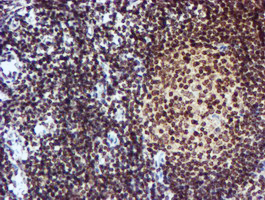 m00615 anti cytochrome p450 17a1 cyp17a1 mouse monoclonal antibody clone id oti3f11 ihc testing 8