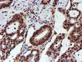m00615 anti cytochrome p450 17a1 cyp17a1 mouse monoclonal antibody clone id oti3f11 ihc testing 9