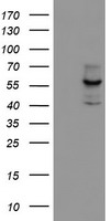 m00615 anti cytochrome p450 17a1 cyp17a1 mouse monoclonal antibody clone id oti3f11 wb testing 1