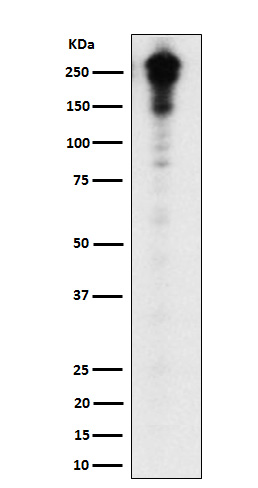 Western blot analysis of Desmoplakin expression in A431 cell lysate