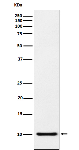 Western blot analysis of RANTES expression in RANTES recombinant protein lysate