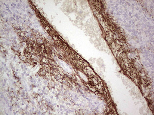 Immunohistochemical staining of paraffin-embedded Human tonsil within the normal limits using anti-CSF1 mouse monoclonal antibody