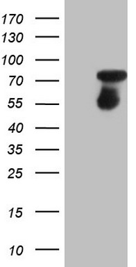 HEK293T cells were transfected with the pCMV6-ENTRY control (Left lane) or pCMV6-ENTRY CSF1 (Right lane) cDNA for 48 hrs and lysed