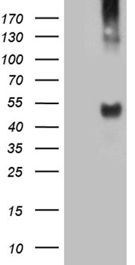 HEK293T cells were transfected with the pCMV6-ENTRY control (Left lane) or pCMV6-ENTRY TAT (Right lane) cDNA for 48 hrs and lysed