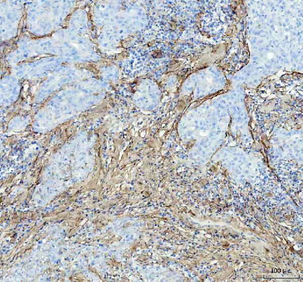  IHC analysis of Collagen I using anti-Collagen I antibody (M00624)