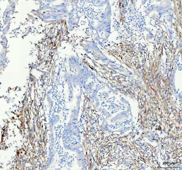  IHC analysis of Collagen I using anti-Collagen I antibody (M00624)