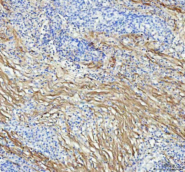m00624 col1a1 primary antibodies ihc testing 4