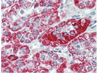 m00625 trpc6 primary antibodies ihc testing 1