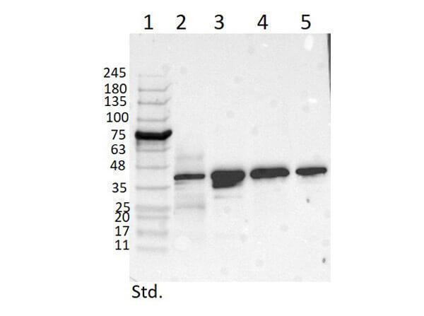 m00625 trpc6 primary antibodies wb testing 2