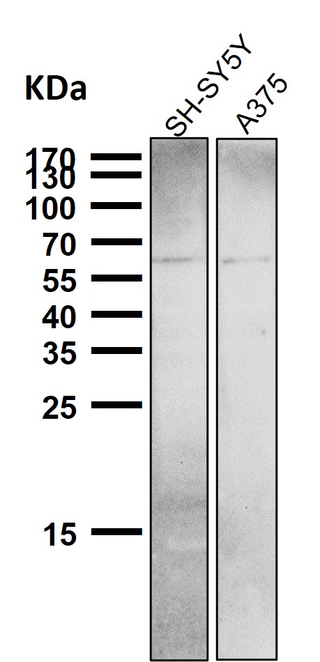 All lanes use the Antibody at 1:6K dilution for 1 hour at room temperature