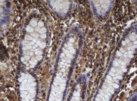 Immunohistochemical staining of paraffin-embedded Human colon tissue within the normal limits using anti-APEX1 mouse monoclonal antibody