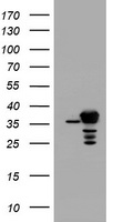 HEK293T cells were transfected with the pCMV6-ENTRY control (Left lane) or pCMV6-ENTRY APEX1 (Right lane) cDNA for 48 hrs and lysed