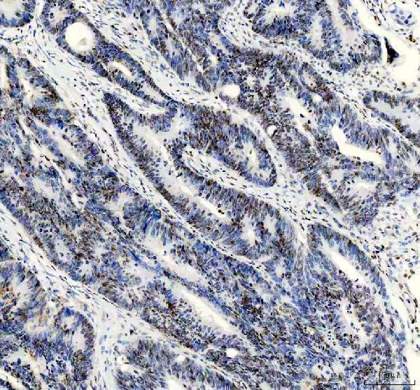  IHC analysis of APEX1 using anti-APEX1 antibody (M00627-3) 