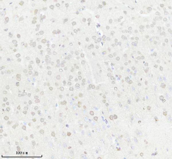 IHC analysis of SUMO1 using anti-SUMO1 antibody (M00631-1)