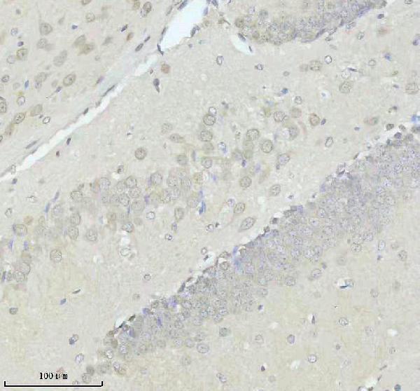 IHC analysis of SUMO1 using anti-SUMO1 antibody (M00631-1)