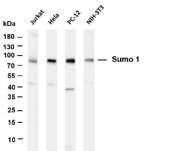 Various whole cell lysates were separated by 4-20% SDS-PAGE, and the membrane was blotted with anti-Sumo 1 antibody