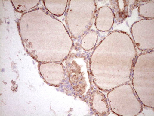m00634 1 anti osteopontin spp1 mouse monoclonal antibody clone id oti5e4 ihc testing 4