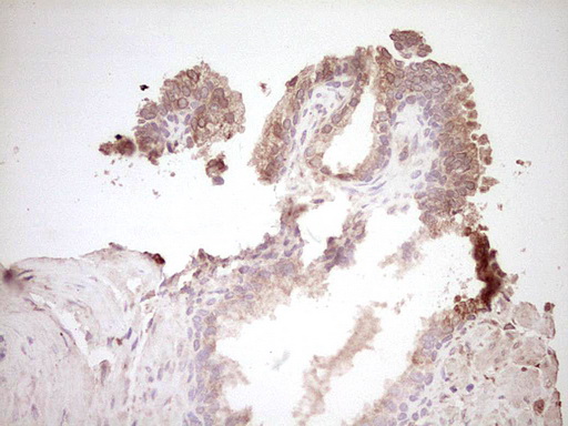 m00634 1 anti osteopontin spp1 mouse monoclonal antibody clone id oti5e4 ihc testing 5