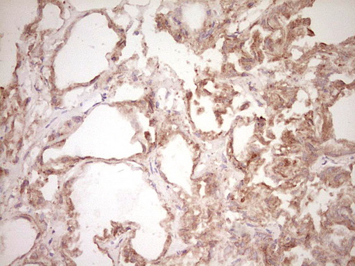 m00634 1 anti osteopontin spp1 mouse monoclonal antibody clone id oti5e4 ihc testing 6