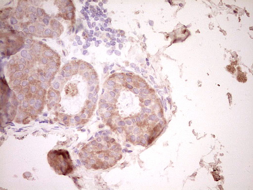 m00634 1 anti osteopontin spp1 mouse monoclonal antibody clone id oti5e4 ihc testing 7