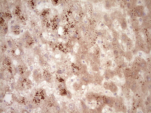 m00634 1 anti osteopontin spp1 mouse monoclonal antibody clone id oti5e4 ihc testing 8