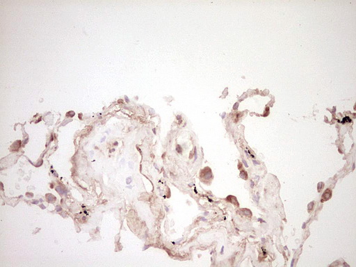 m00634 1 anti osteopontin spp1 mouse monoclonal antibody clone id oti5e4 ihc testing 9