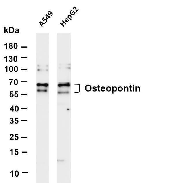 Various whole cell lysates were separated by 4-20% SDS-PAGE, and the membrane was blotted with anti-Osteopontin antibody