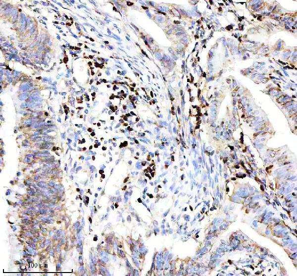  IHC analysis of SPP1 using anti-SPP1 antibody (M00634)