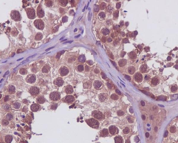 Immunohistochemical analysis of paraffin-embedded human testis, using PRMT5 Antibody 