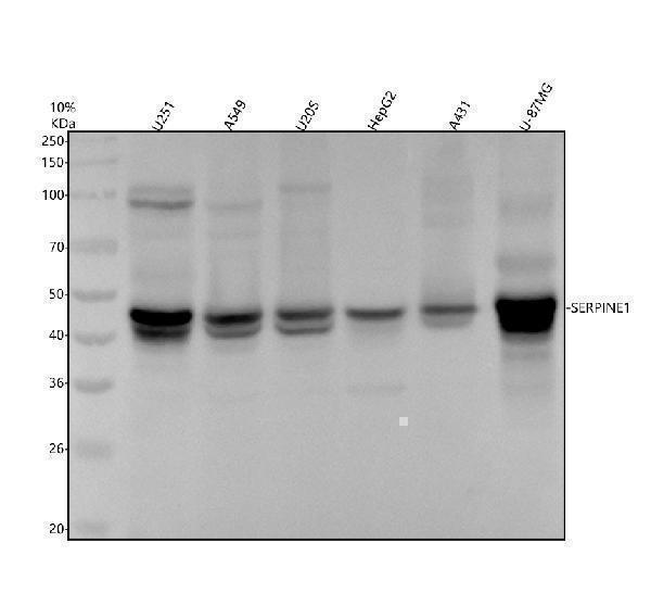 Western blot analysis of PAI-1/SERPINE1 using anti-PAI-1/SERPINE1 antibody (M00637)