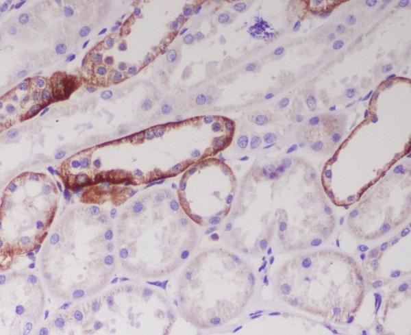 m00640 1 ihc