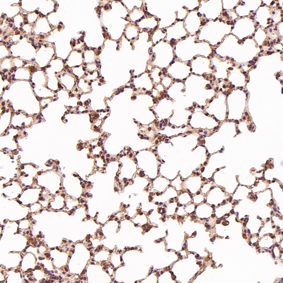 Immunohistochemical analysis of paraffin-embedded Rat liver, using the Antibody at 1:200 dilution