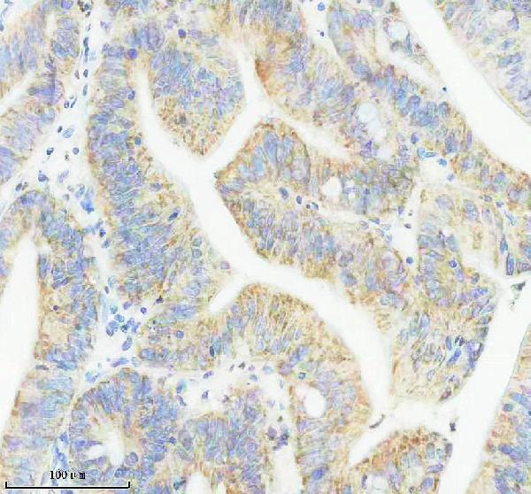 IHC analysis of JAG1 using anti-JAG1 antibody (M00640-2)