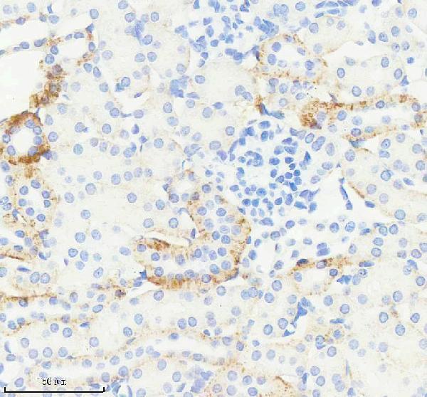 IHC analysis of JAG1 using anti-JAG1 antibody (M00640-2)