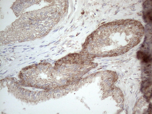 Immunohistochemical staining of paraffin-embedded Human prostate tissue within the normal limits using anti-JAG1 mouse monoclonal antibody