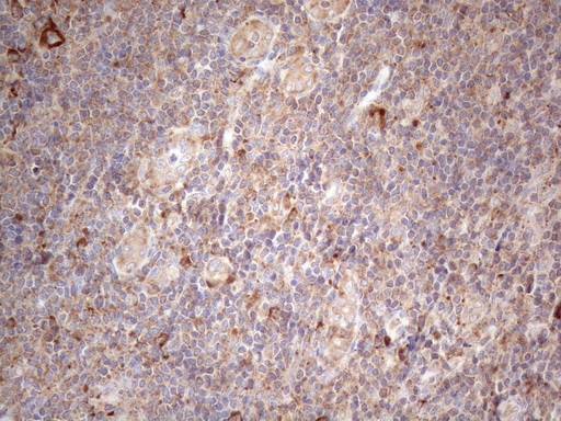 m00640 anti jagged1 jag1 mouse monoclonal antibody clone id oti3a10 ihc testing 7