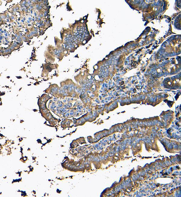  IHC analysis of MVP using anti-MVP antibody (M00642-1)