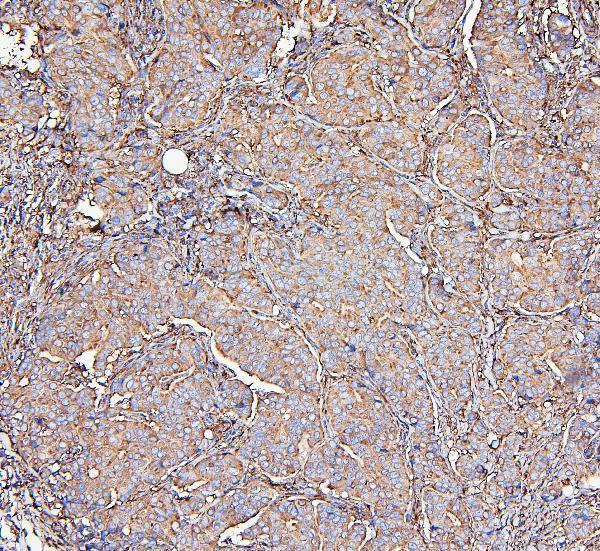 m00642 1 _mvp_ primary antibodies ihc testing 5