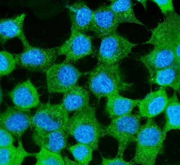  IF analysis of MVP using anti-MVP antibody (M00642-1)