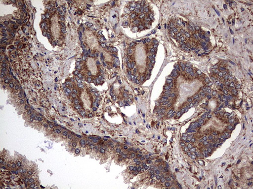 m00651 2 anti il1ra il1rn mouse monoclonal antibody clone id oti2b1 ihc testing 10