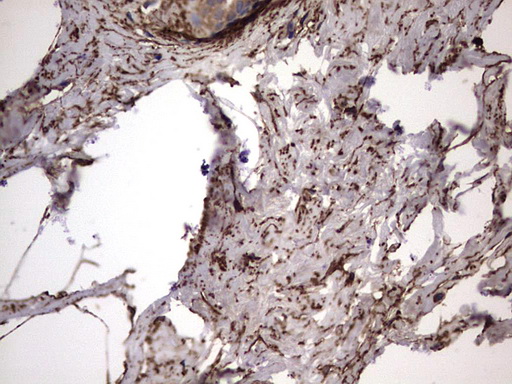 m00651 2 anti il1ra il1rn mouse monoclonal antibody clone id oti2b1 ihc testing 11