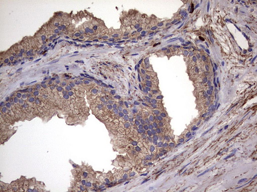 m00651 2 anti il1ra il1rn mouse monoclonal antibody clone id oti2b1 ihc testing 12