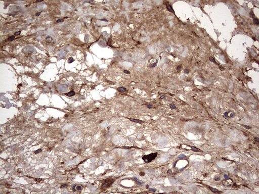 m00651 2 anti il1ra il1rn mouse monoclonal antibody clone id oti2b1 ihc testing 13