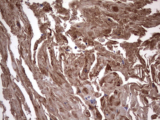 m00651 2 anti il1ra il1rn mouse monoclonal antibody clone id oti2b1 ihc testing 14