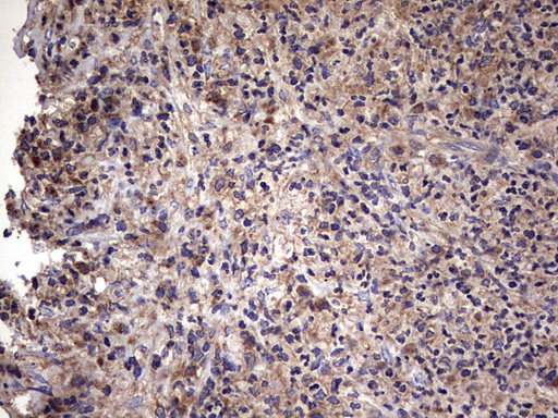 m00651 2 anti il1ra il1rn mouse monoclonal antibody clone id oti2b1 ihc testing 15