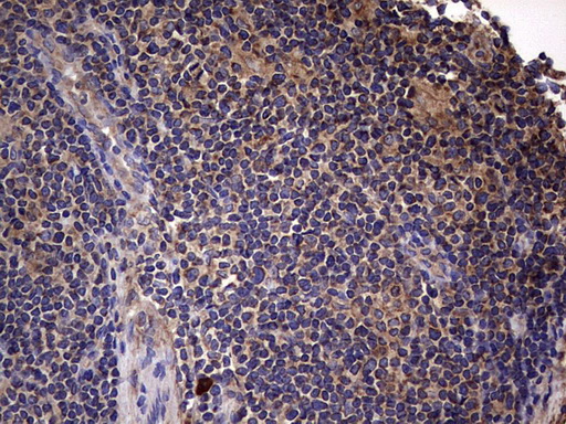 m00651 2 anti il1ra il1rn mouse monoclonal antibody clone id oti2b1 ihc testing 16